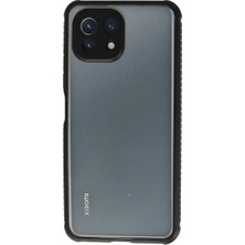 Ulu Pazarlama Xiaomi Mi 11 Lite Kılıf Miami Şeffaf Silikon - Siyah