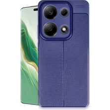 Ulu Pazarlama Xiaomi Redmi Note 13 Pro 4g Kılıf Auto Focus Kapak - Lacivert
