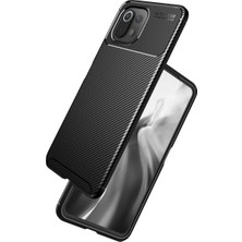 Kaia Life Mi 11 Lite Kılıf Auto Fus Karbon Kapak - Siyah