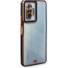 SiHako Newface Redmi Note 10 Kılıf Liva Lens Silikon -