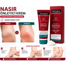 Neutrogena Nasır Önleyüci Krem 50ML