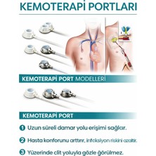 Port Katater 8 Fr Poliüretan