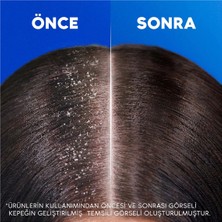 Head&Shoulders Head & Shoulders 2'si 1 Arada Klasik Bakım Kepek Şampuan 625 ml Dökülen Saçlar için Etkili Bakım