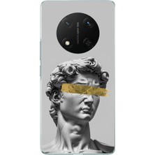 TechTree Honor X9C Uyumlu Modern Hellenistik Davut Baskılı Silikon Kılıf