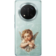 TechTree Honor X9C Uyumlu Cupid's Dream (Eros’un Rüyası) Baskılı Silikon Kılıf