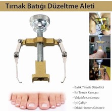 Mabeyn Batık Tırnak Düzeltme Aleti - Vida Mekanizması ve Iki Tırnak Kancasıyla Etkili Batık Tırnak Tedavisi - Hızlı Sonuç ve Kolay Kullanım | BT19