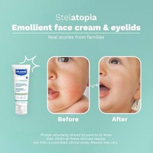 Assess Store Stelatopia Emollient Yüz Kremi (40ML)