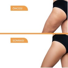 Assess Store Vücut Sıkılaştırıcı Krem, Selülit Karşıtı, Çatlak Görünümü Azaltıcı, Nemlendirici, Toparlayıcı Bakım Kremi