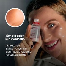 Assess Store Akne Karşıtı Losyon 30 ml
