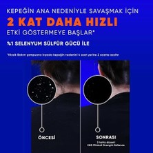 Daisy Home & Shoulders Clinical Strength Dry Scalp Rescue Kuru Saç Derisine Özel Şampuan 400 ml