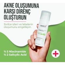 Daisy Home Veela Ac Control Cream – Akneli Ciltler Için Onarıcı Krem |%2 Salisilik Asit &%5 Niasinamid | Sivilce ve Leke Karşıtı Etkili Bakım