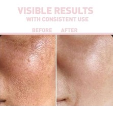 Daisy Home Nıacınamıde%10 + Hyaluronıc Acıd%2 Serum