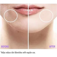 Teknocan Maruderm Leke Karşıtı Cilt Serumu 30 ml