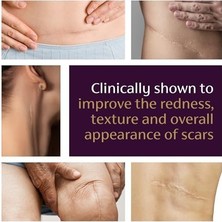 Teknocan Mederma No:1 Advanced Scar Gel 20GR