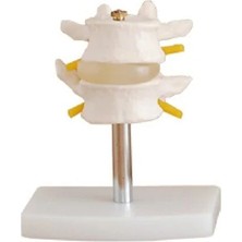 EgeAnatomi Maketleri Lumbar Vertebra Modeli 2 Omurlu