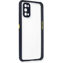 Durukar®  Realme 7 Pro Kılıf Miami Şeffaf Silikon - Lacivert
