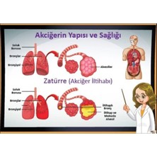 Prime Concept Akciğerin Yapısı ve Zatürre Afişi (Vinil) 50X70 cm