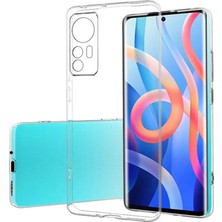 Mir Kitap Newface Xiaomi Mi 12 Kılıf Lüx Şeffaf Silikon