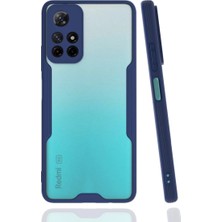 Newface Xiaomi Redmi Note 11T Kılıf Platin Silikon - Lacivert