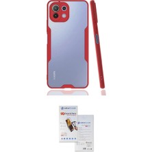 Nuveden Ieg™ Mi 11 Lite Kılıf Atlas Asil Serisi - Siyah Seramik Nano Ekran Koruyucu