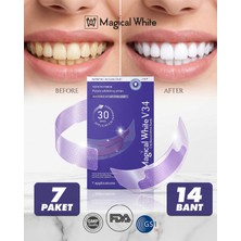 Magical White V34 Mor Diş Beyazlatma Bandı - Sarılık Karşıtı Renk Düzeltici Diş Beyazlatıcı Şerit Seti (7 Paket/14 Adet)