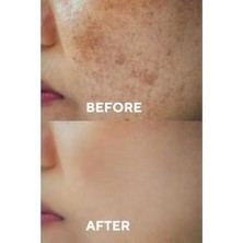 The Ceel Leke Karşıtı ve Cilt Tonu Eşitleyen Cilt Serumu, Glutatyon & Niacinamide Etkili 30 ml