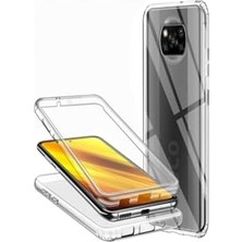 X3 Nfc 360 Kılıf Şeffaf Ön Arka Korumalı Silikon Kmp ile Uyumlu