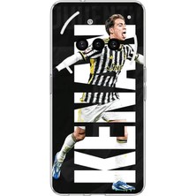 TechTree Nothing Phone (3A) Uyumlu Kenan Yıldız Sevinç Baskılı Silikon Kılıf