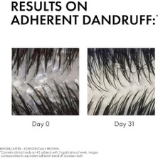 Vıchy Dercos Anti Dandruff Kuru Saçlar Için Kepek Karşıtı Şampuan 200 ml