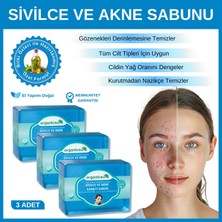 Organicsun Doğal Akne Ve Sivilce Karşıtı Sabun 140 Gr X 3 Adet Tüm Cilt Tipleri Için Natural Sabun
