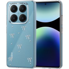 Ototechparca    Redmi Note 14 Pro 4g Fiyonk Desenli Kapak - Desen 1