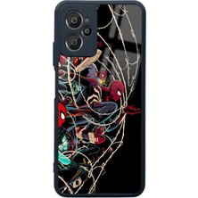 Spoyi Casper X30 Plus Spider Earth Tasarımlı Glossy Telefon Kılıfı