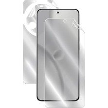 AyrStore 15 Ultra Için Ipg Hydrogel Tam Kaplama (Ekran ve Arka Koruyucu)