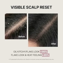 Simplyo Saç Derisi ve Saç Bakımı Için Doğal Çözüm | Refreshing Scalp Shampoo Flower, Kore'den Ithal