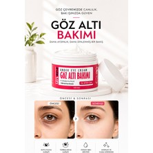Göz Altı Torba ve Morluk & Koyu Halka Karşıtı Yoğun Nemlendirici Göz Altı Aydınlatıcı Krem 100 ml