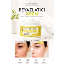 Adarise Koltuk Altı-Diz-Dirsek Ve Bikini Bölgesi Cilt Beyazlatıcı Krem 100 ml