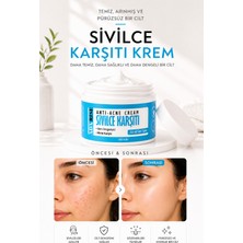 Adarise Sivılce Önleyici ve Sivılce Karşıtı Akne Siyah Nokta Giderici Krem 100 ml
