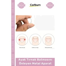 Carlburn Özel Üretim Paslanmaz Çelik Ergonomik Tırnak Düzeltici Seti Ayak Tırnak Batmasını Önleyen Metal Aparat