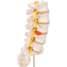 3b Scientific A76/5 Bel Omurga Sütunu, Dorso-Lateral Prolapsed Intervertebral Disk, 34 cm Yükseklik