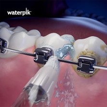 Waterpik Beyazlatıcı Ortodontik Başlık, Diş Tellerinin Temizliği Için Yedek Başlık, Protez, 2'li Paket (Wod-2e)