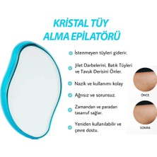 İbico Ibico Ibc-9 Epılator ( Kristal ) Tüy Alma EPILATÖRÜ*400
