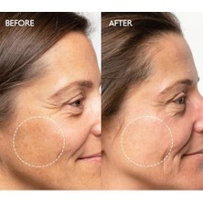 Beyazlatıcı Etkili Leke Karşıtı Bakım Kremi Arbutin Yüzde Iki Brightening Krem 50ML