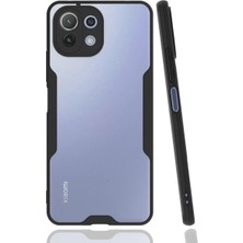 SDT Newface Xiaomi Mi 11 Lite Kılıf Platin Silikon - Siyah