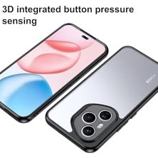 Prime - Honor ile Uyumlu 400 Pro Kılıf Kamera Korumalı Kenarları Renkli Arkası Şeffaf Yumuşak Kenar Silikon Sert Kapak