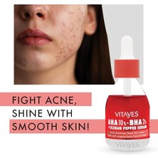 Prime Vıtayes Aha%10 Bha%2 Kırmızı Peeling Cilt Serumu - Gözenek Sıkılaştırıcı, Cilt Canlandırıcı, Yenileyici, Ton Eşitleyici, Arındırıcı, Siyah Nokta ve Akne Karşıtı, Anti-Aging, Yaşlanma Karşıtı 30 ml