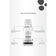 Prime Sos Siyah Nokta Oluşumuna Karşı Cilt Bakım Serumu 20 ml