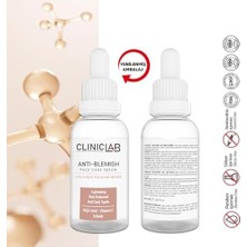 Defne Store Leke Karşıtı Yüz Bakım Serumu 30 ml