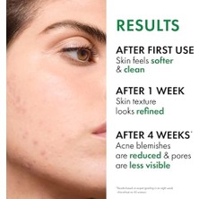 Defne Store Normaderm Phytosolution Günlük Bakım Kremi 50 ml