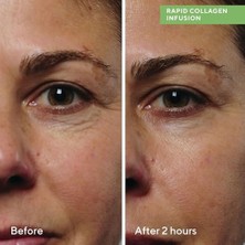 Defne Store Murad Collagen Infusion Anında Sıkılaştırıcı Kolajen Serumu (30 Ml)