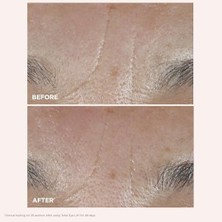 Defne Store Total Eye Lift Göz Kremi 15 ml